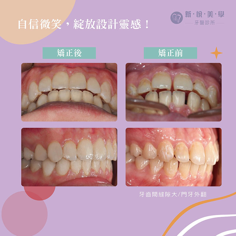 及時矯正，設計精彩人生！的第2張圖片